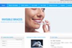 Invisible Braces