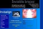 Invisible Braces Invisible Braces